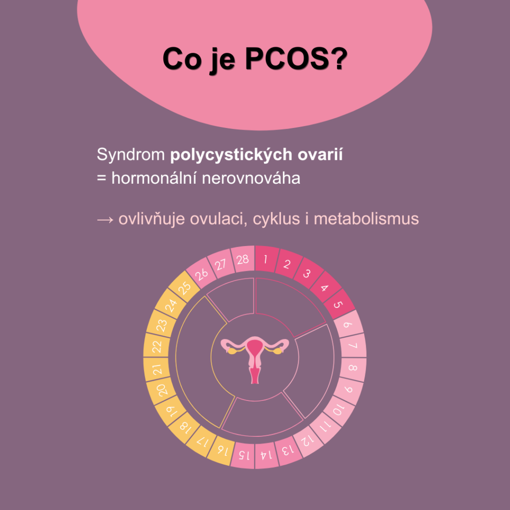 PCOS je syndrom polycystických ovarií. Ovlivňuje ovulaci, menstruační cyklus a metabolismus jako takový
