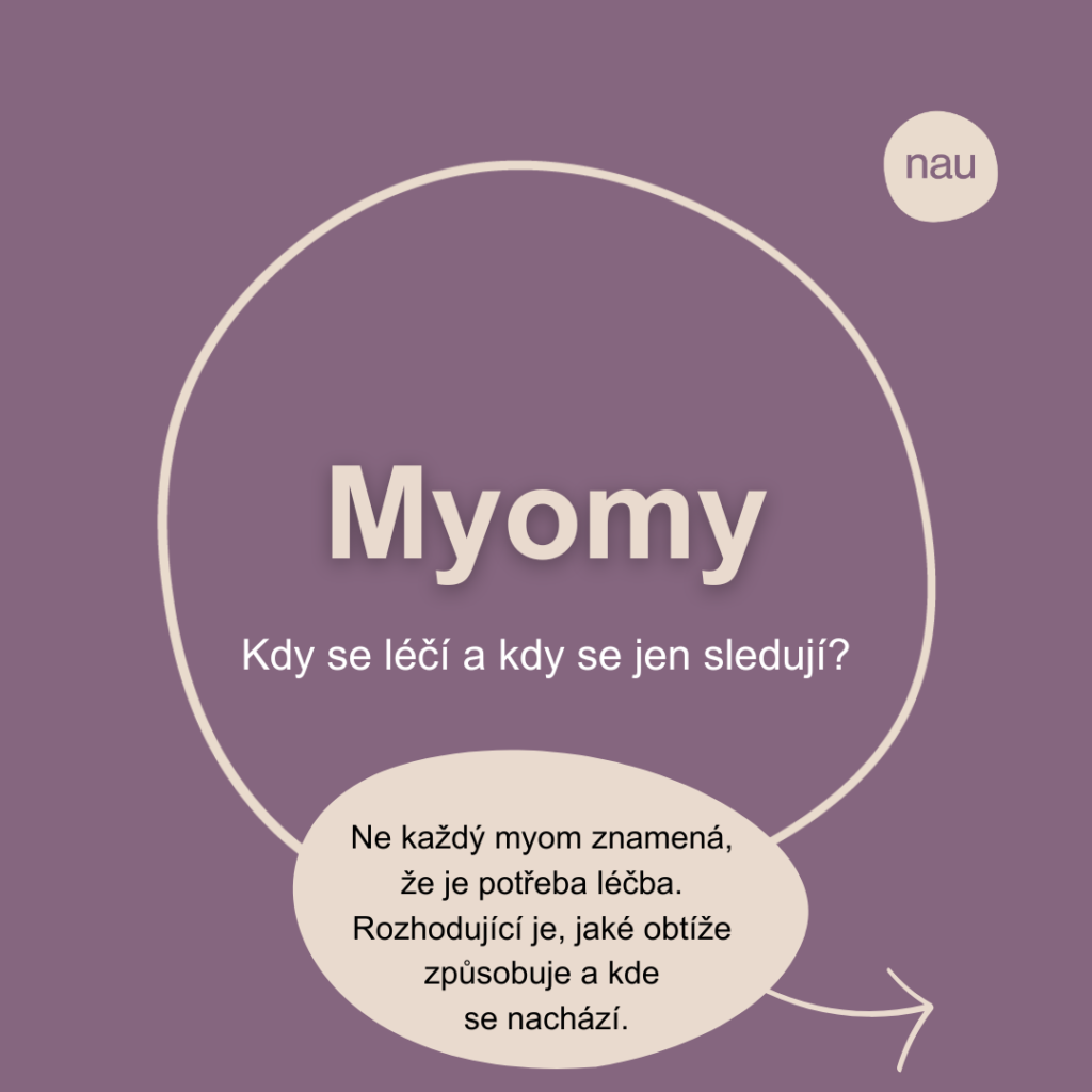 Ne každý myom je potřeba léčit. Důležitá je poloha myomy a jeho působení.
